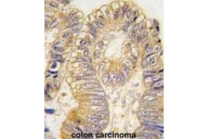 Immunohistochemistry (IHC) image for anti-Chloride Intracellular Channel 5 (CLIC5) antibody (ABIN3003306) (CLIC5 抗体)