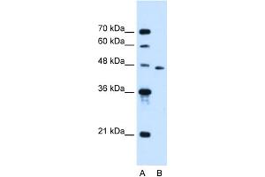 Western Blotting (WB) image for anti-Solute Carrier Family 16, Member 12 (Monocarboxylic Acid Transporter 12) (SLC16A12) (N-Term) antibody (ABIN2781754)