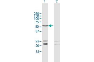 Western Blot analysis of C1orf103 expression in transfected 293T cell line by C1orf103 MaxPab polyclonal antibody. (C1orf103 抗体  (AA 1-436))
