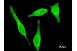 Immunofluorescence of monoclonal antibody to STAU1 on HeLa cell. (STAU1/Staufen 抗体  (AA 401-496))