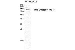 Western Blotting (WB) image for anti-Neurotrophic Tyrosine Kinase, Receptor, Type 2 (NTRK2) (pTyr516) antibody (ABIN3179513) (TRKB 抗体  (pTyr516))