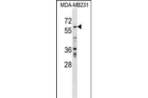 ZN Antibody (N-term) (ABIN1539343 and ABIN2849295) western blot analysis in MDA-M cell line lysates (35 μg/lane). (ZNF543 抗体  (N-Term))