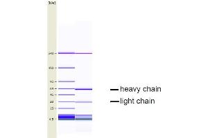 CGE analysis of purified EQ-8D11-C1 monoclonal antibody.