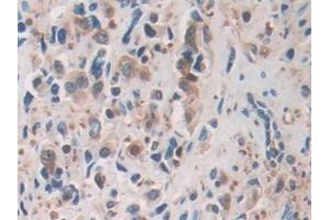 Immunohistochemistry (IHC) image for anti-Cofilin 1 (CFL1) (AA 3-161) antibody (ABIN7433783)