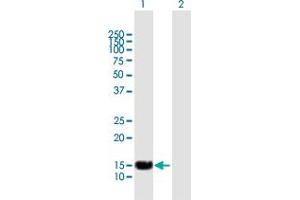 Western Blot analysis of SP140 expression in transfected 293T cell line by SP140 MaxPab polyclonal antibody. (SP140 抗体  (AA 1-172))
