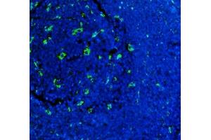 IF analysis of CD68 using anti-CD68 antibody (ABIN7600142).