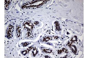 Image no. 2 for anti-Nibrin (NBN) (AA 183-460) antibody (ABIN1491059) (Nibrin 抗体  (AA 183-460))