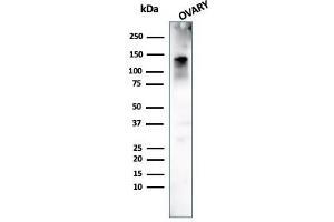 Western Blot Analysis of human Ovary tissue using Caldesmon Mouse Monoclonal Antibody (h-CALD). (Caldesmon 抗体)