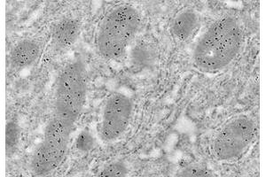 Immunoelectron microscopy analysis of LR white resin-embedded mouse liver using HSP60 (ABIN7074167) at dilution of 1: 50. (HSPD1 抗体)