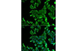 Immunofluorescence analysis of HeLa cells using STOM antibody (ABIN5973779). (Stomatin 抗体)