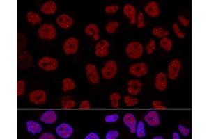 Confocal immunofluorescence analysis of Hela cells using CTCF Polyclonal Antibody at dilution of 1:200. (CTCF 抗体)
