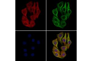 ABIN6262659 and ABIN6277905 staining Hela cells by IF/ICC. (IRG1 抗体  (C-Term))