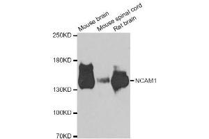 Western blot analysis of extracts of various cell lines, using NCAM1 antibody. (CD56 抗体  (AA 759-858))