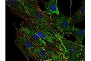 Immunofluorescence staining of AHNAK1 in human primary fibroblasts using anti-AHNAK1 (EM-09 ; green).