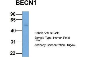 Host: Rabbit  Target Name: BECN1  Sample Tissue: Human Fetal Heart  Antibody Dilution: 1. (Beclin 1 抗体  (Middle Region))