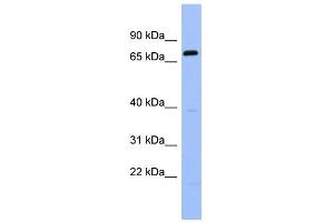 WB Suggested Anti-RGS9 Antibody Titration: 0. (RGS 抗体  (Middle Region))