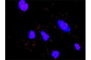 Proximity Ligation Analysis of protein-protein interactions between STK11 and STRADA. (STRADA 抗体  (AA 251-346))