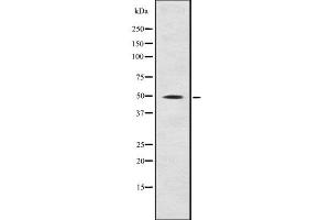 Western blot analysis Fgl2 using Jurkat whole cell lysates (FGL2 抗体  (C-Term))