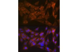 Immunofluorescence analysis of C6 cells using CLEC3B/CLEC3B/Tetranectin Rabbit mAb (ABIN1679326, ABIN3018879, ABIN3018880 and ABIN7101681) at dilution of 1:100 (40x lens). (CLEC3B 抗体)