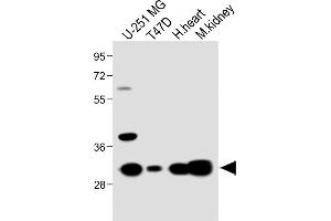 All lanes : Anti-RCH5 Antibody (N-term) at 1:1000 dilution Lane 1: U-251 MG whole cell lysate Lane 2: T47D whole cell lysate Lane 3: Hun heart lysate Lane 4: Mouse kidney lysate Lysates/proteins at 20 μg per lane. (MARCH5 抗体  (N-Term))