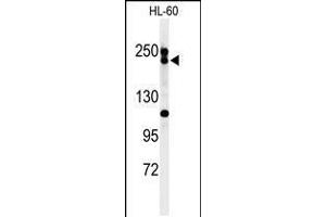 Western blot analysis of BLM Antibody in HL-60 cell line lysates (35ug/lane) (BLM 抗体  (C-Term))
