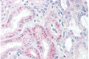 Human Kidney (formalin-fixed, paraffin-embedded) stained with AES antibody ABIN213897 at 5 ug/ml followed by biotinylated goat anti-rabbit IgG secondary antibody ABIN481713, alkaline phosphatase-streptavidin and chromogen. (AES 抗体  (N-Term))