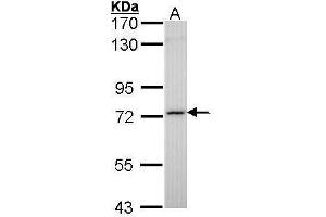 WB Image Sample (30 ug of whole cell lysate) A: Molt-4 , 7. (SDHA 抗体  (N-Term))