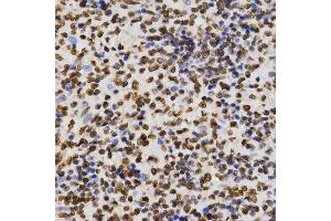 Immunohistochemistry of paraffin-embedded human kidney using DiMethyl-Histone H3-K27 antibody. (Histone 3 抗体  (H3K27me))