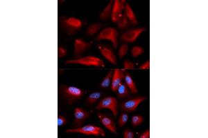 Immunofluorescence analysis of U2OS cells using S100A11 antibody.