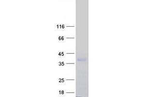 Western Blotting (WB) image for CD99 Molecule-Like 2 (CD99L2) (Transcript Variant 1) protein (Myc-DYKDDDDK Tag) (ABIN2713820)