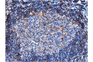 Immunohistochemical staining of paraffin-embedded Human lymph node tissue using anti-ARHGAP25 mouse monoclonal antibody. (ARHGAP25 抗体)