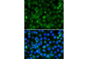 Immunofluorescence analysis of A549 cell using HIST2H4B antibody. (Histone Cluster 2, H4b (HIST2H4B) 抗体)