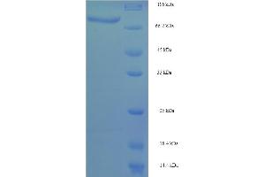 SDS-PAGE (SDS) image for Cytochrome P450, Family 4, Subfamily F, Polypeptide 11 (CYP4F11) (AA 38-524) protein (His-SUMO Tag) (ABIN5711833) (CYP4F11 Protein (AA 38-524) (His-SUMO Tag))