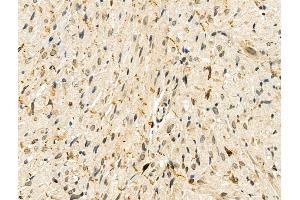 Phospho-ZEB2 (Ser784) Antibody at 1/100 staining Rat heart tissue by IHC-P. (ZEB2 抗体  (pSer784))