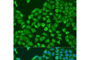 Immunofluorescence analysis of U2OS cells using PUM1 Polyclonal Antibody at dilution of 1:100. (PUM1 抗体)