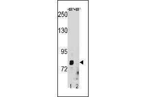 ZT1 Antibody (C-term) (ABIN1882011 and ABIN2843232) western blot analysis in HepG2 cell line lysates (35 μg/lane). (ZMAT1 抗体  (C-Term))