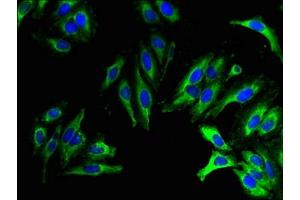 Immunofluorescent analysis of Hela cells using ABIN7173195 at dilution of 1:100 and Alexa Fluor 488-congugated AffiniPure Goat Anti-Rabbit IgG(H+L) (TMEM27 抗体  (AA 206-265))