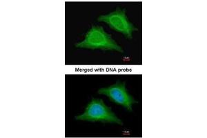 ICC/IF Image Immunofluorescence analysis of paraformaldehyde-fixed HeLa, using AMPK gamma-2, antibody at 1:200 dilution. (PRKAG2 抗体  (full length))