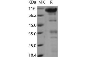 Western Blotting (WB) image for C-Type Lectin Domain Family 14, Member A (CLEC14A) protein (Fc Tag) (ABIN7321192) (CLEC14A Protein (Fc Tag))