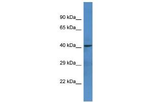 Western Blotting (WB) image for anti-Netrin G1 (NTNG1) (C-Term) antibody (ABIN2788417) (Netrin G1 抗体  (C-Term))