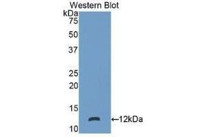 Detection of recombinant S100P using Polyclonal Antibody to S100 Calcium Binding Protein P (S100P) (S100P 抗体  (AA 1-95))