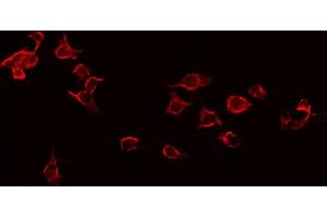 ABIN6268971 staining Hela by IF/ICC. (CD247 抗体  (pTyr142))