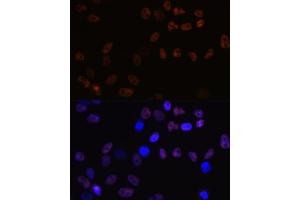 Immunofluorescence analysis of HeLa cells using MCM7 Rabbit mAb (ABIN7268544) at dilution of 1:100 (40x lens). (MCM7 抗体)