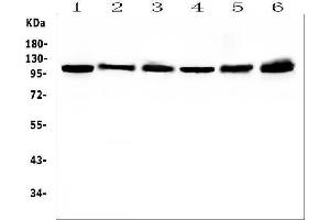 Western blot analysis of HSPH1 using anti-HSPH1 antibody (ABIN7602237).