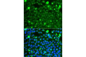 Immunofluorescence analysis of A549 cells using HSPE1 antibody. (HSPE1 抗体)