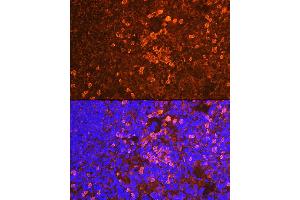 Immunofluorescence analysis of mouse spleen using CD19 Rabbit pAb (ABIN3023663, ABIN3023664, ABIN3023665 and ABIN6219683) at dilution of 1:100 (40x lens). (CD19 抗体  (AA 351-556))