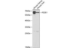 Western blot analysis of extracts of various cell lines, using PDZK1 antibody (ABIN6128428, ABIN6145422, ABIN6145423 and ABIN6220948) at 1:1000 dilution. (PDZK1 抗体  (AA 1-260))