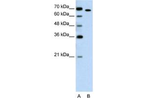 Western Blotting (WB) image for anti-RAR-Related Orphan Receptor A (RORA) antibody (ABIN2462864) (RORA 抗体)