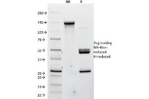 SDS-PAGE Analysis Purified P-Cadherin Mouse Monoclonal Antibody (12H6). (P-Cadherin 抗体)