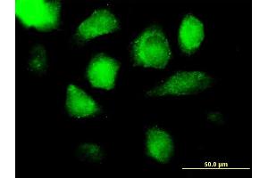Immunofluorescence of purified MaxPab antibody to AZU1 on HeLa cell.